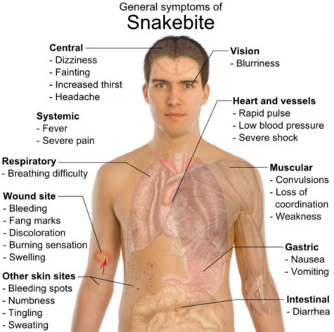 Snake_bite_symptoms